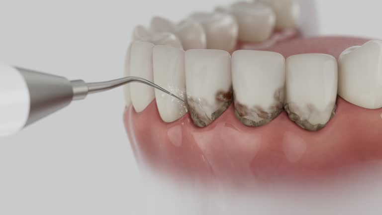 Reliable Dental contractor in Crockett, CA by Dentist Open Now